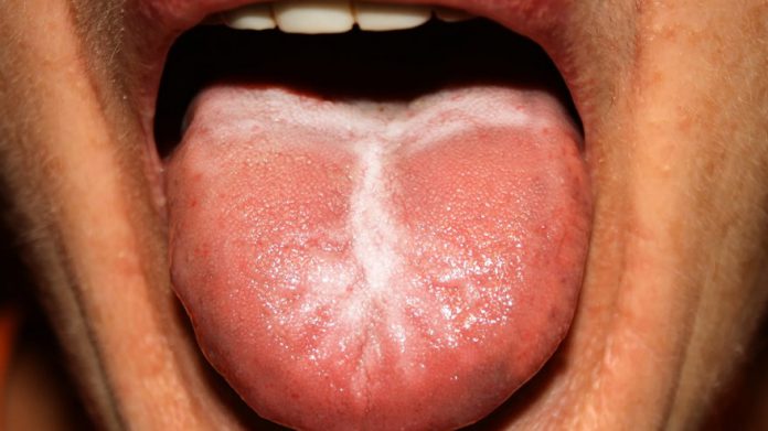 Jakie są przyczyny metalicznego posmaku w ustach?
